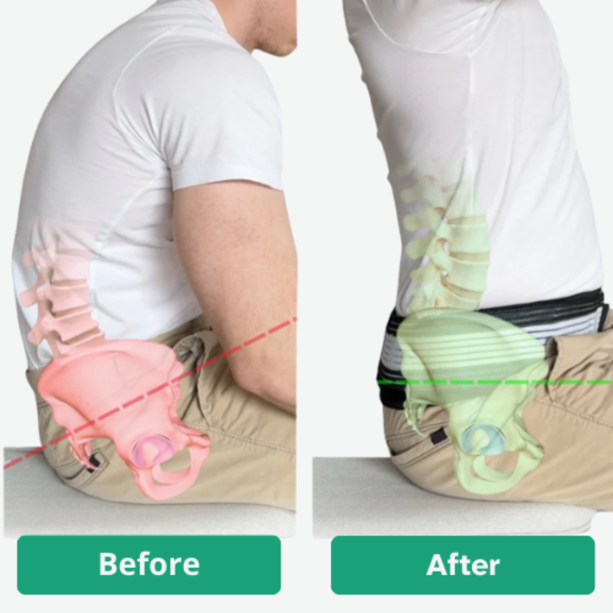 Flexura™ – Move Freely, Live Pain-Free